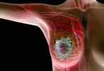 Breast Cancer Awareness Month Prompts Doctors to Share 5 Vital Health Tips for Working Women to Lower Disease Risk