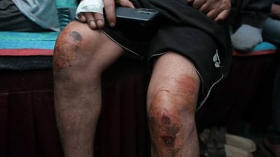 Day After Lathicharge And Tear Gas, Anger Against Delhi Police Brutality Rends The Air At Jantar Mantar