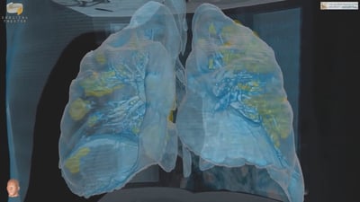 Effects of Coronavirus explained through virtual reality.