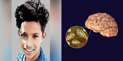 Is the brain-eating amoeba a new threat?