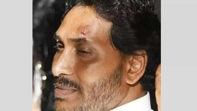 Chief Minister YS Jagan Mohan Reddy Injured in Stone Pelting Incident During Campaign Rally in Vijayawada